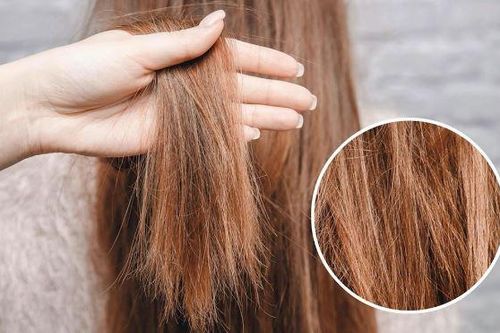 Nguyên nhân khiến tóc bạn ngày càng xơ xác