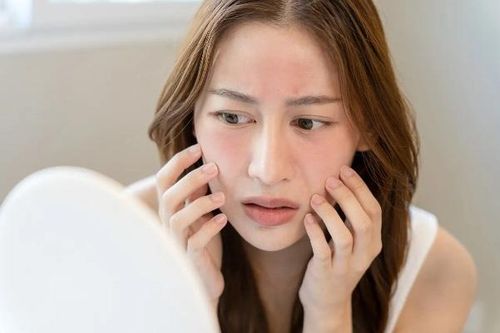 Tại sao da bạn nhạy cảm?
