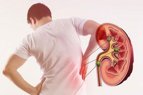 7 thói quen xấu gây hỏng thận nhanh nhất có thể bạn đang mắc phải