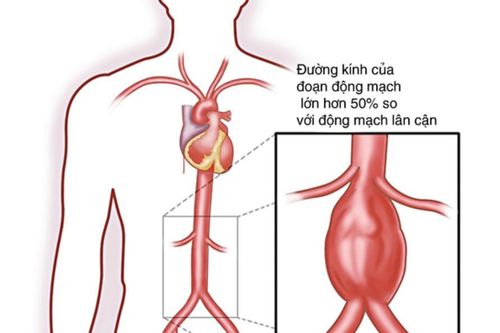 Cảnh báo căn bệnh khiến 60% người tử vong trước khi đến bệnh viện