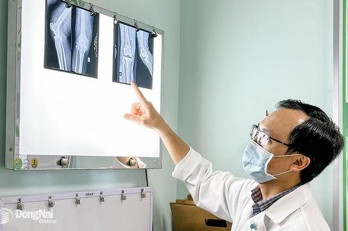 Thay toàn bộ khớp gối cho cụ ông bị thoái hóa khớp gối nặng