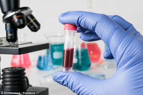 Xét nghiệm máu có thể dự đoán sớm bệnh Alzheimer