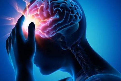 Lời khuyên từ bác sĩ cho người thiếu máu não