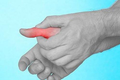 Biểu hiện thường gặp của bệnh gout cấp và cách xử trí