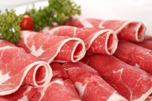 Bác sĩ chỉ điểm 5 nguyên nhân gây bệnh sỏi thận hàng đầu hiện nay, số 1 rất quen mặt