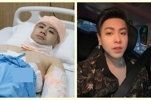 Ngoại hình của Akira Phan sau 4 năm chi 300 triệu 'dao kéo'