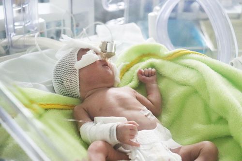 5 lời khuyên của bác sĩ khi chăm sóc trẻ sinh non
