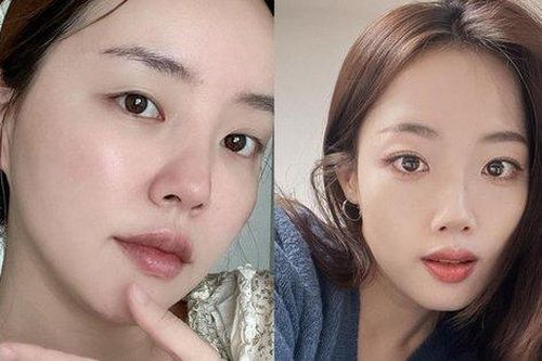 4 sản phẩm chăm sóc da bác sĩ khuyên các chị em nên ít dùng