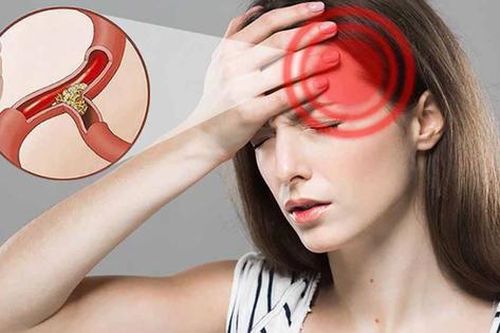 Bác sĩ cảnh báo dấu hiệu của thiếu máu não thoáng qua