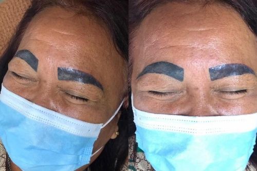 Tin tưởng bạn thân xăm lông mày, người phụ nữ tỉnh dậy hú hồn