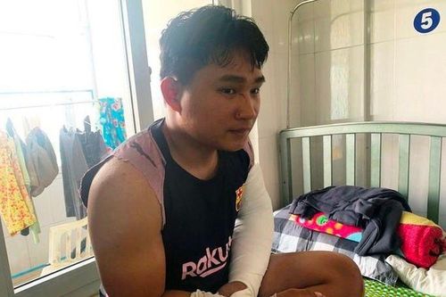 Hai vợ chồng đánh shipper gãy tay: Có xử lý hình sự?