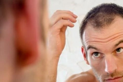 Mờ mắt, rụng tóc vì… sex quá nhiều
