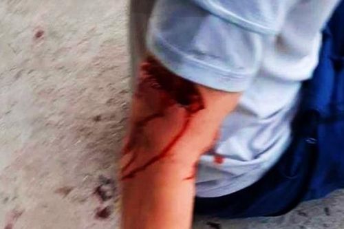 Du khách bị chó tấn công khi đang tản bộ tại phố biển Nha Trang