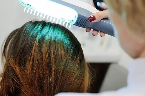 Cấy tóc, mọc tóc, giảm mỡ bụng - máy lazer làm được hết: Chuyên gia nói gì?