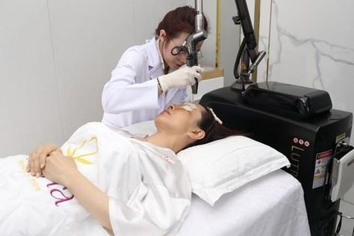 Đón đầu xu hướng trị nám năm 2023 với công nghệ Hollywood Spectra