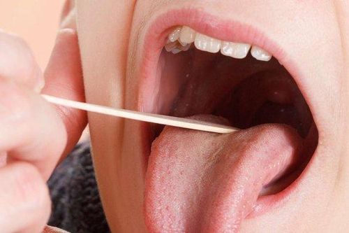 Điểm danh 7 biến chứng viêm VA thường gặp
