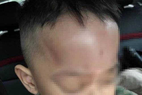 Phụ huynh tố cô giáo bạo hành trẻ, công an kết luận ra sao?