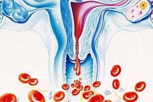 Rong kinh có gây thiếu máu không?
