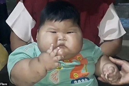 Cậu bé 16 tháng có trọng lượng ngang trẻ 8 tuổi