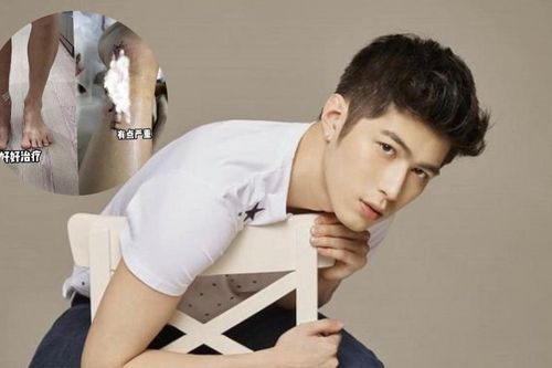 Một nam diễn viên bị tai nạn bị thương nặng, phải ngồi xe lăn