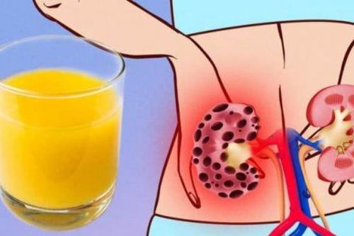 7 loại thực phẩm gây hại cho thận, nhiều người lại coi đấy là 'món tủ'