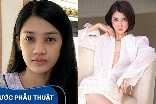 Trình Mỹ Duyên 'lột xác' sau phẫu thuật thẩm mỹ