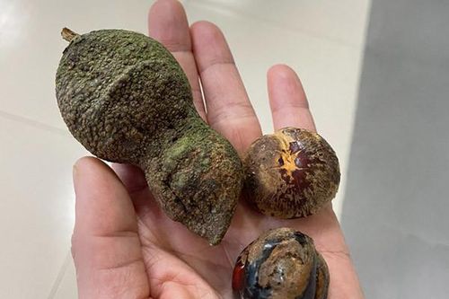 Hôn mê, suy đa tạng sau khi ăn loại quả giống hạt dẻ
