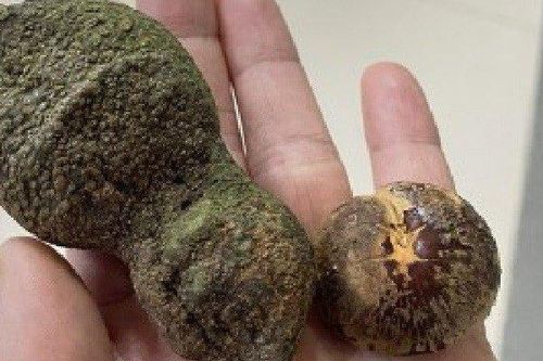 Người đàn ông nguy kịch do ăn nhầm loại quả giống hạt dẻ