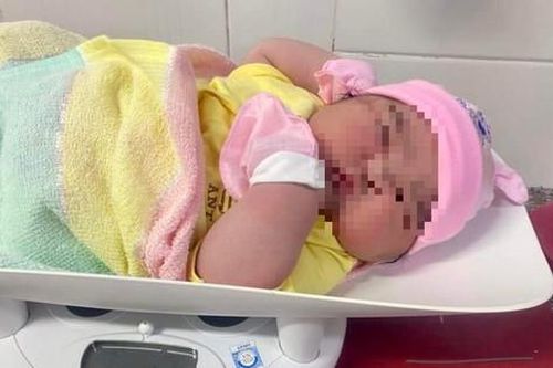 Bé gái sơ sinh chào đời với cân nặng 'khủng' 6kg