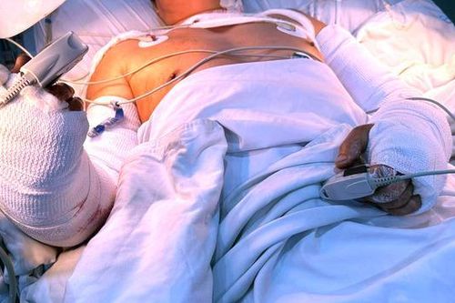 Hy hữu bệnh nhân bị đứt lìa 2 cẳng tay được nối thành công
