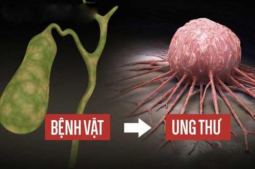 5 loại 'bệnh vặt' không lo chạy chữa ngay, để lâu sẽ biến thành mầm ung thư cực nguy hiểm