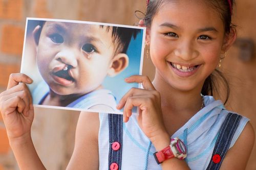 Corine de Farme kết hợp cùng tổ chức Operation Smile 'lan tỏa nụ cười trẻ thơ'