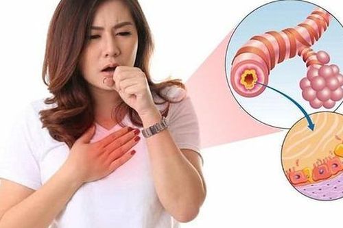 Viêm phế quản mạn tính ở người lớn