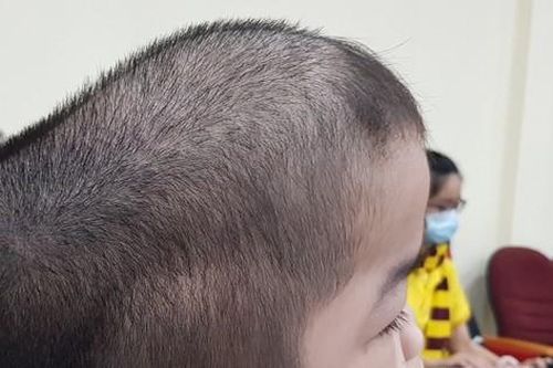 Khoảng 6 triệu người Việt Nam đang mắc bệnh hiếm