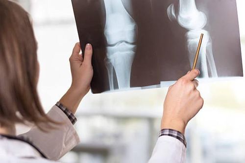 Đóng đinh hai chân cho bệnh nhi gãy xương đùi