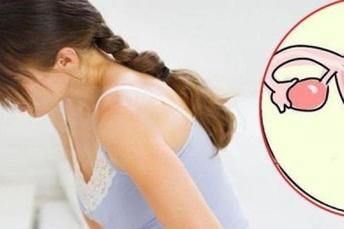 Dấu hiệu nhận biết u xơ tử cung, chị em cần biết để đi khám ngay