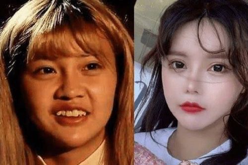 Hốt hoảng nhan sắc người mẫu Hàn An Nhiễm trước khi 'dao kéo'