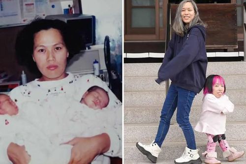 Chị em sinh đôi lệch nhau gần 1m lập kỷ lục thế giới