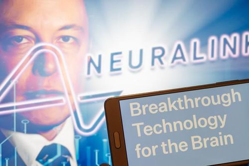 Dự án cấy chip vào não người của tỷ phú Elon Musk gặp trở ngại lớn
