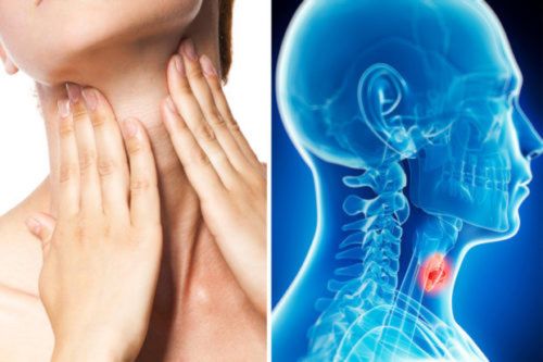 Dấu hiệu ung thư vòm họng sớm