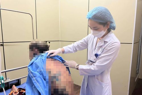 Tự mua thuốc uống, nam thanh niên bị dị ứng nhiễm độc nặng