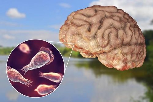 Những điều cần biết về amip ăn não người