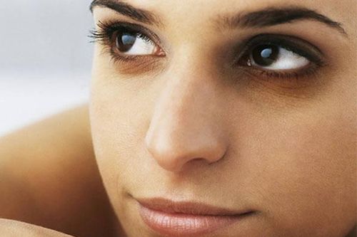 Giảm quầng thâm mắt không khó như bạn nghĩ