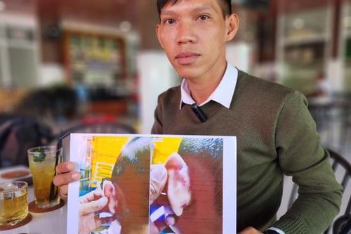 Kiên Giang: Đánh trẻ gây thương tích một cô giáo mầm non bị khởi tố