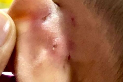 Bạo hành bé trai 4 tuổi thương tích, cô giáo mầm non bị khởi tố