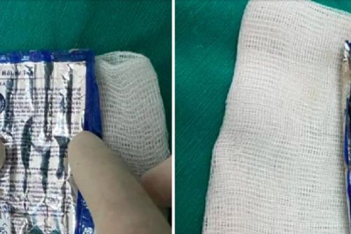 Tá hỏa phát hiện vỏ kem xả tóc trong niệu đạo cụ ông