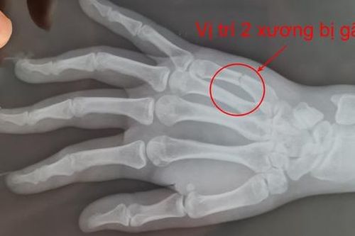 Hà Nội: Công an điều tra vụ người phụ nữ bị đánh sảy thai khi đi ăn tối