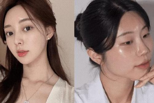 5 sai lầm khiến serum vitamin C kém hiệu quả