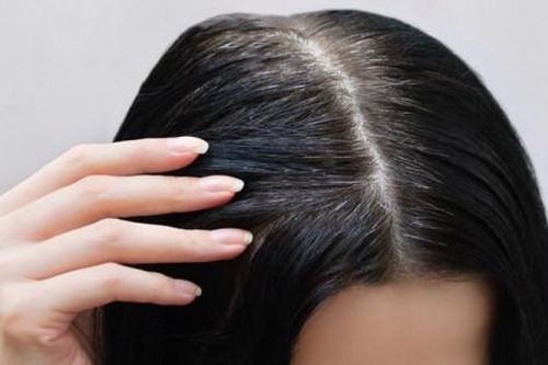 9 mẹo tuyệt vời giúp bạn chống lại tình trạng tóc bạc sớm