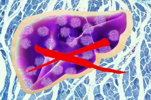 Phát hiện loại virus mới gây bệnh viêm gan ở một bệnh nhân nữ